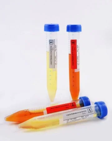 Btnx Rapid Response Ctl 2X12Ml Control Liquid Urine Diptube – AUCT-1V1