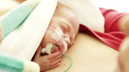 Medela Neonatal Nasogastric Feeding Tube 8 Fr. 42 Inch Tube Pvc Sterile – ENPV4280