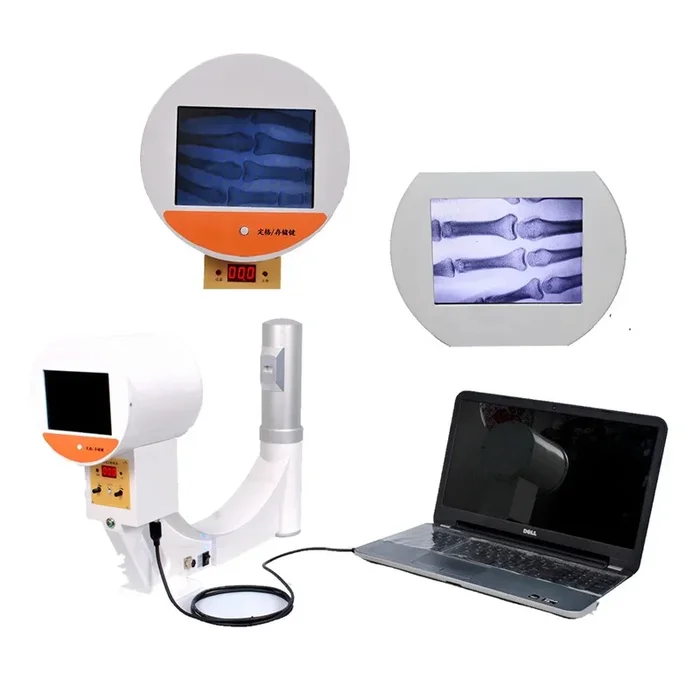 Portable X-Ray and Fluoroscopy Machine: Advanced Imaging on the Go