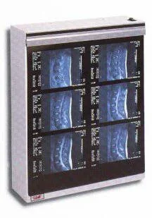 Wolf X-Ray MG-7 X-Ray Illuminator 1 Bank 1 Tier 2 Lamp 15 W Free Standing – 21104